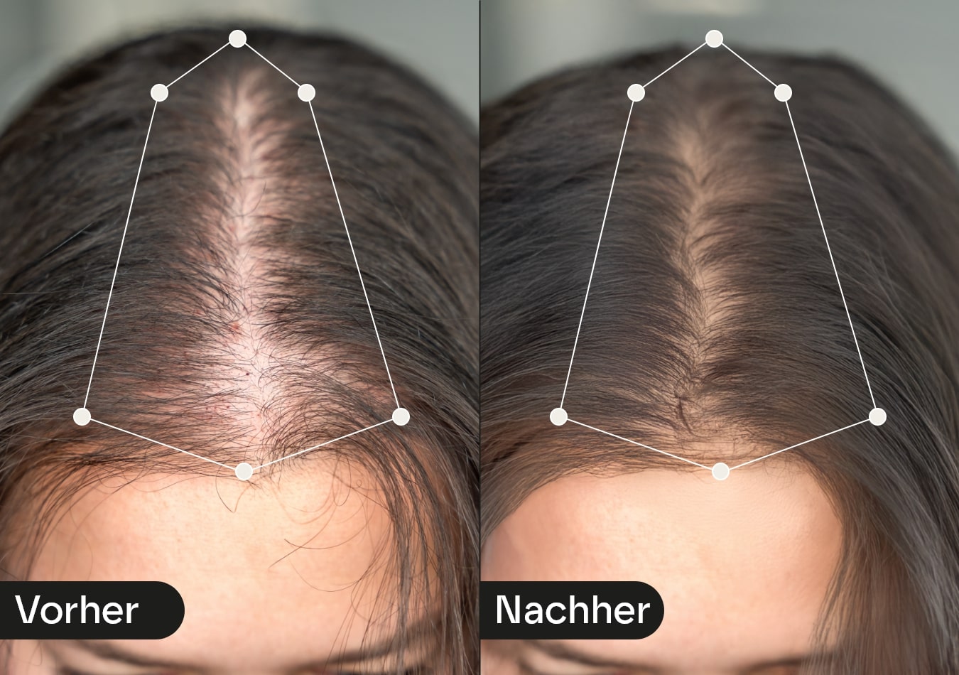 Wie lange dauert es, bis mein Haarwachstums-Supplement wirkt?